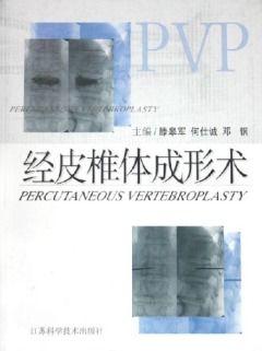 经皮椎体成形术视频